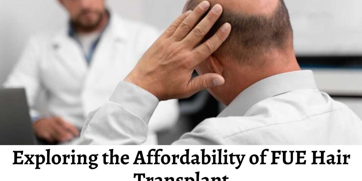 Exploring the Affordability of FUE Hair Transplant