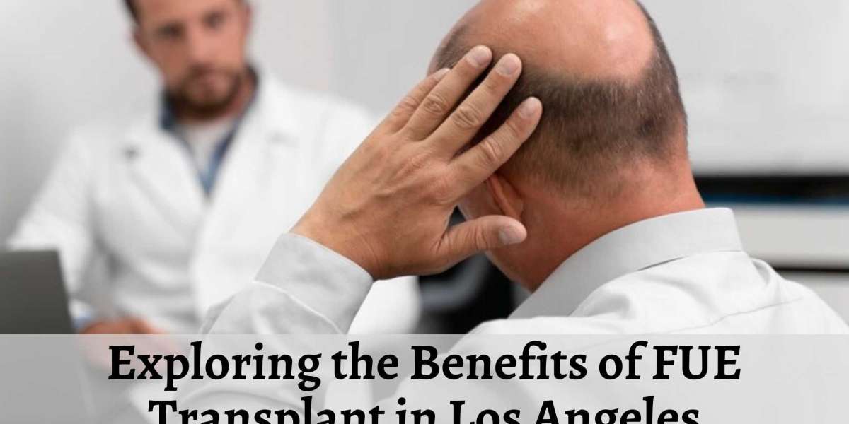 Exploring the Benefits of FUE Transplant in Los Angeles
