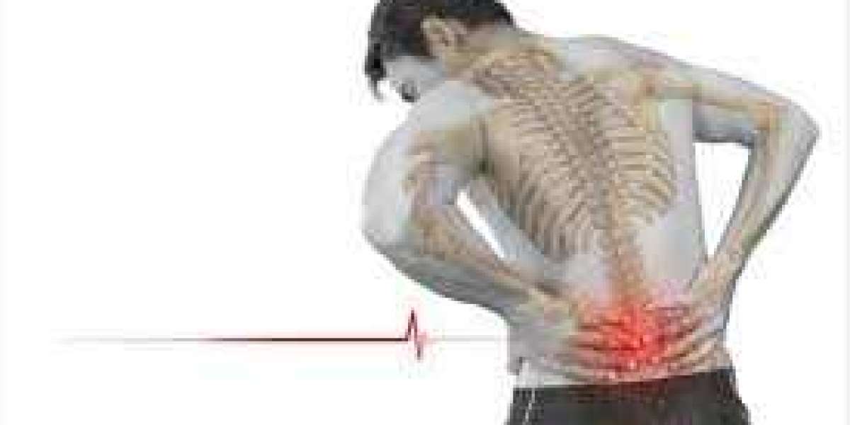 Managing Back Pain: Expert Tips and Self-Care Strategies