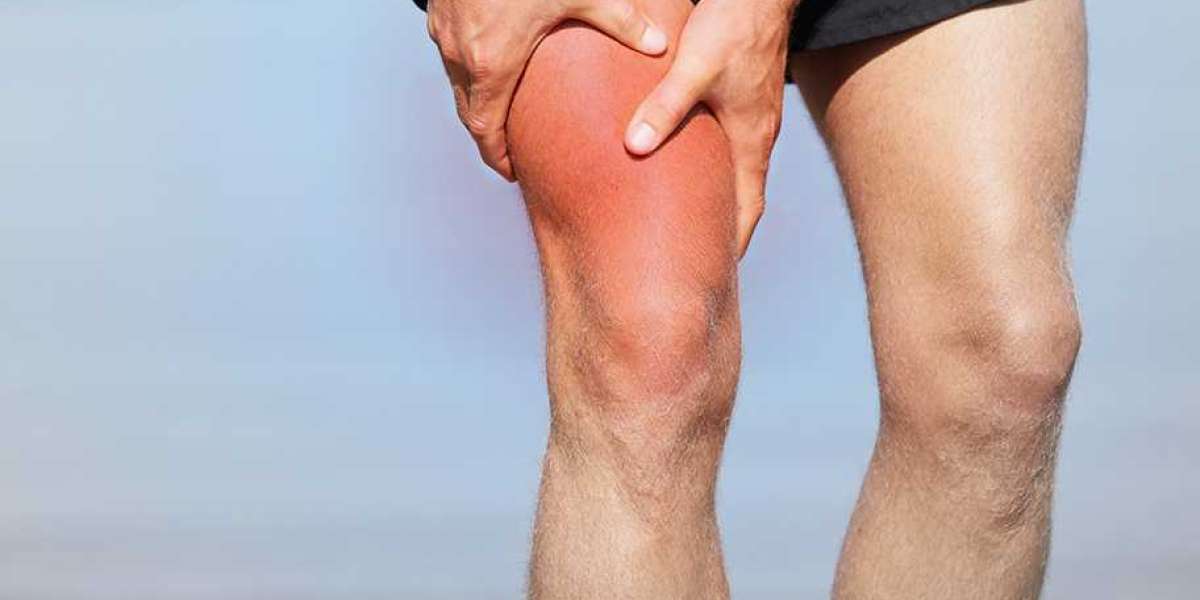Understanding Muscle Pain in the Legs: Causes and Solutions