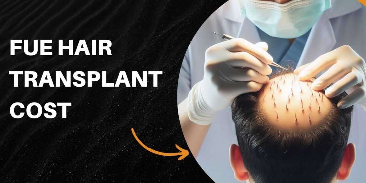 Understanding FUE Hair Transplant Cost: A Comprehensive Guide