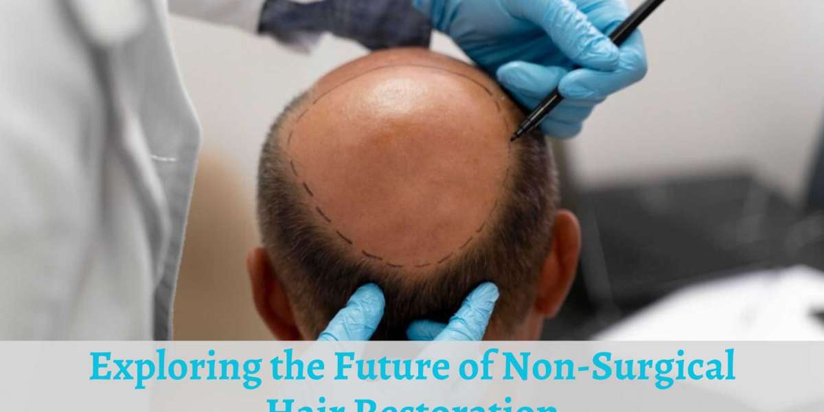 Exploring the Future of Non-Surgical Hair Restoration