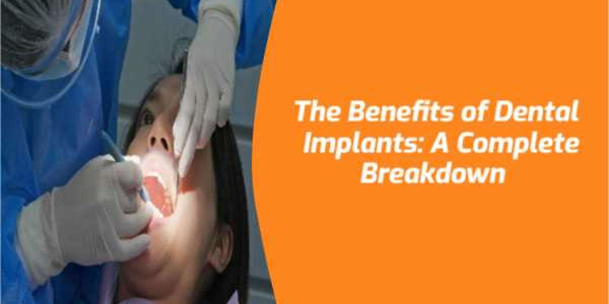 The Benefits of Dental Implants: A Complete Breakdown