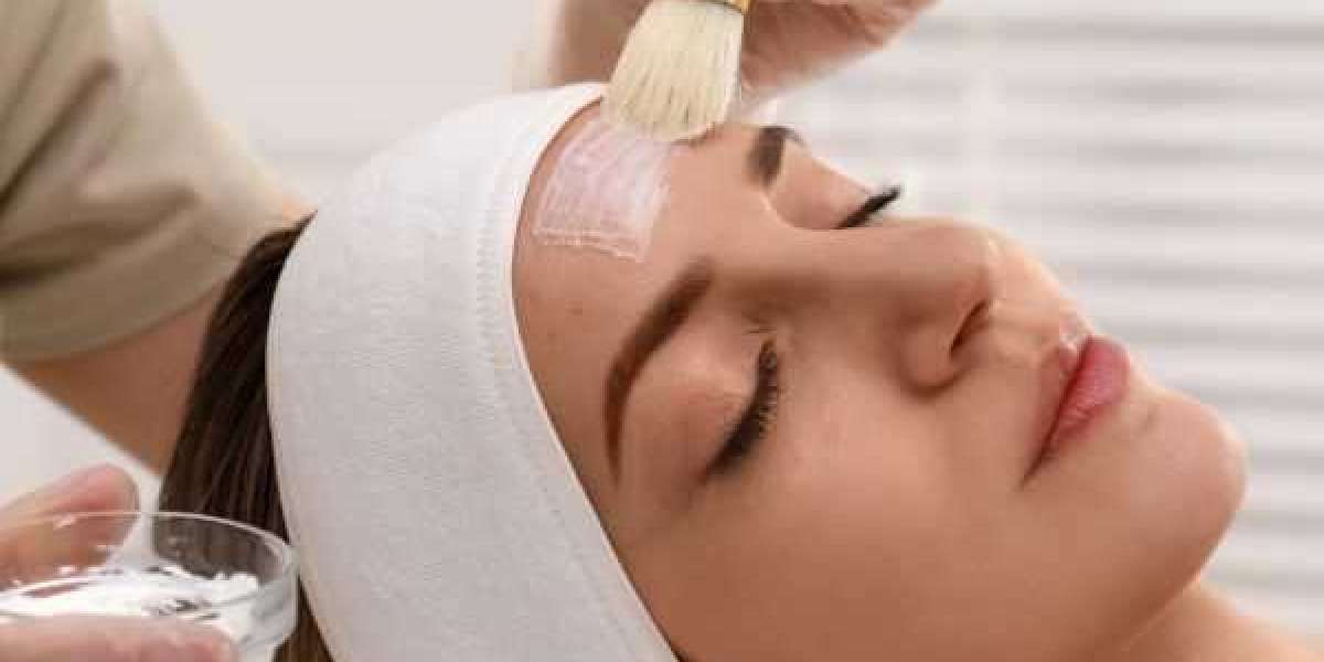 How to Avoid Complications After a Chemical Peel